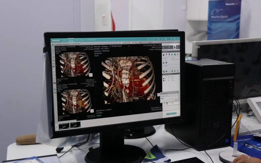 Mongolia Launches First 512-Slice AI CT Scanner